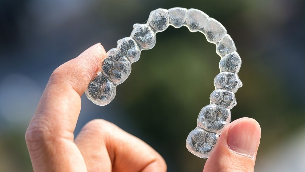 invisalign orthodontics calgary nw