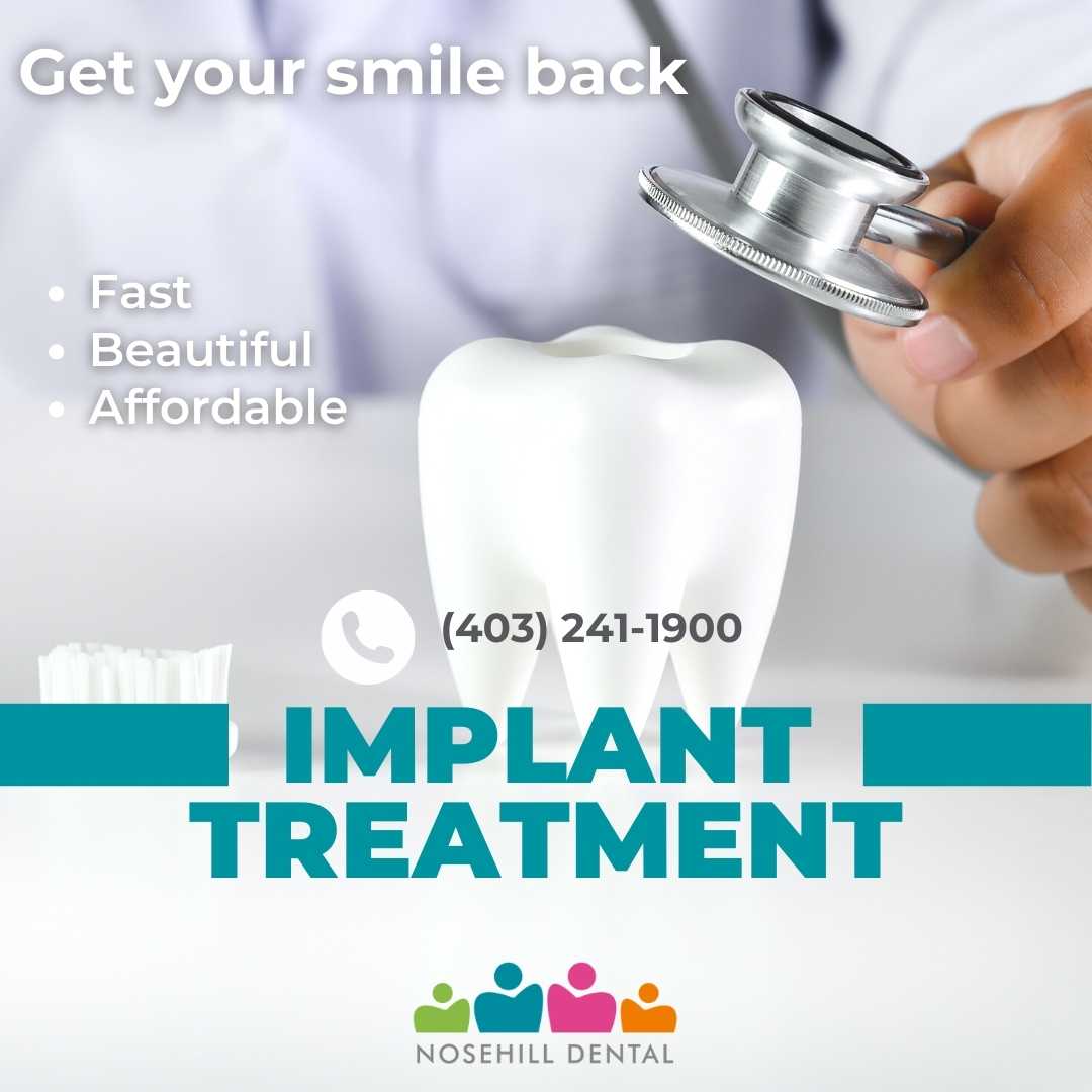 dental implants